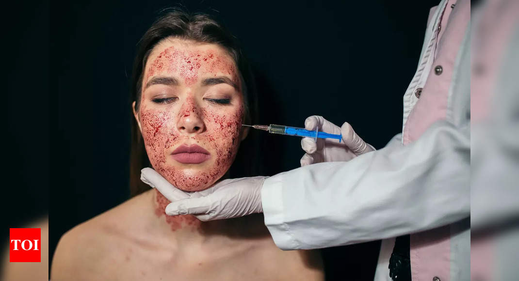 Vampire Facial Treatment: All about Vampire Facial, beauty treatment that left 3 women infected with HIV |