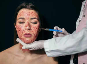 
Unveiling the truth behind the Vampire Facial: Harnessing the body's healing powers for radiant skin
