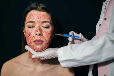 Unveiling the truth behind the Vampire Facial: Harnessing the body's healing powers for radiant skin