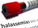 World Thalassemia Day 2024: Symptoms, causes to know