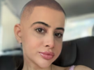
Urfi Javed's bald selfie sparks controversy; shocked fans spot the truth
