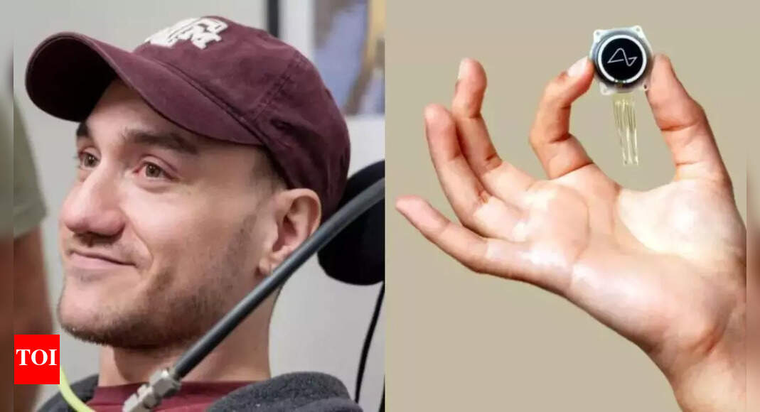 Neuralink&rsquo;s first brain implant patient shares his fears about the device &ndash; Times of India