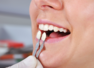 How to care for dental crowns to ensure their longevity