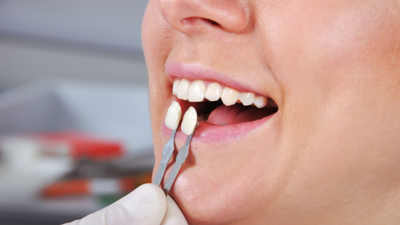 How to care for dental crowns to ensure their longevity