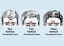 Know what forehead creases (lines) say about an individual's personality