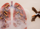 How much does smoking contribute to Lung Cancer?