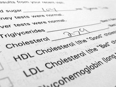 Could it be high cholesterol? Signs on hands and legs to know