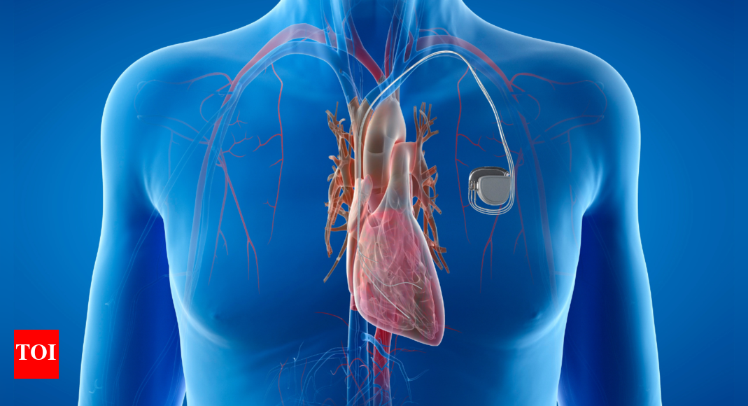Understanding the rising incidences and causes of Arrhythmia: Insights