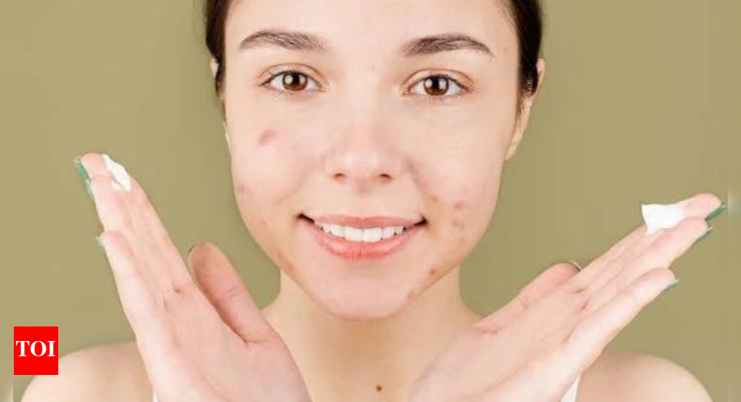 Best Pimple Removal Cream User Favourites and Expert Picks Times of