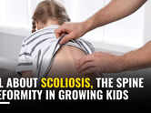 All about Scoliosis, the spine deformity in growing kids
