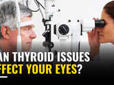 Can thyroid issues affect your eyes?