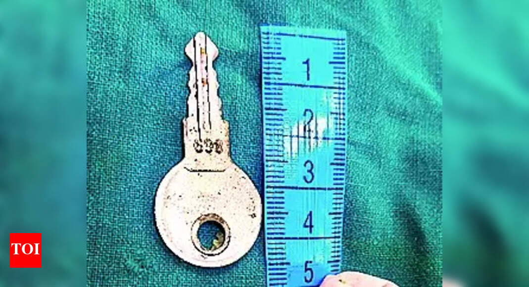 Endoscopy Procedure Key taken out of baby’s food pipe Ahmedabad News