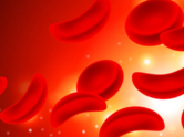 Sickle Cell Disease: Symptoms, risks and understanding those living with sickle cell disease