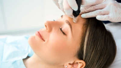 All about Mesotherapy, the French rejuvenation technique