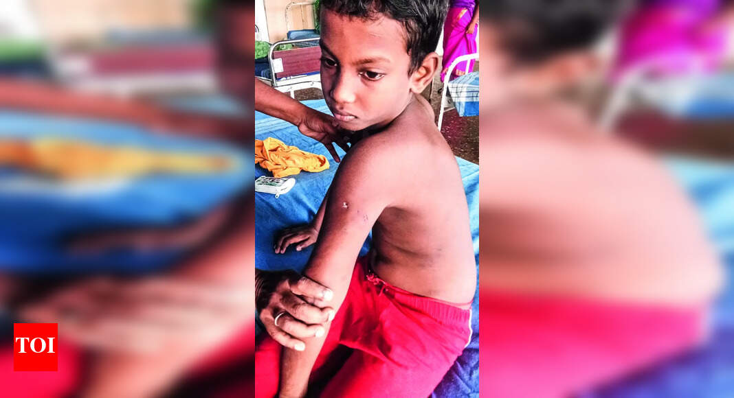Stray Dog Attack: 10-year-old boy injured in stray dog attack in ...
