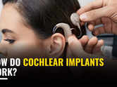 How do Cochlear implants work?