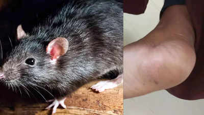 9 students at Medak residential school hostel bitten by rats