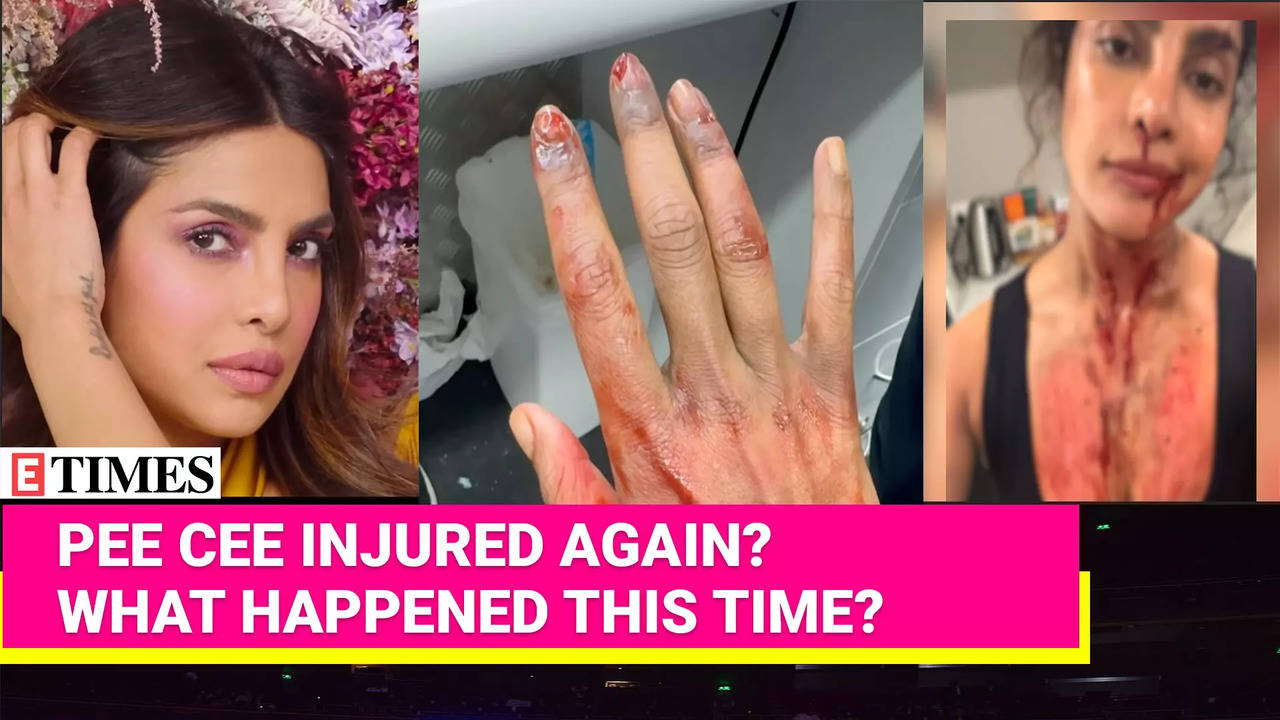 Priyanka Chopra Jonas Injures Her Hand; Is It REAL Or Just For A Movie?