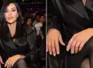 Kim Kardashian describes a gruesome broken finger injury that left her 'bone sticking out', says 'I wanted to die'