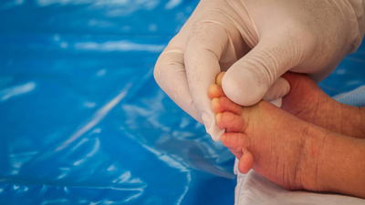 Baby born with Polydactyly condition, has 25 fingers and toes: Know why this happens in newborns