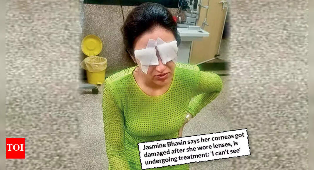 Don’t sleep with your lenses on, check expiry dates Eye experts