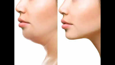 Is jawline correction surgery right choice for you? Expert opinions from Gurgaon doctors