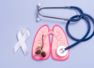 World Lung Cancer day 2024: Debunking 5 myths about lung cancer