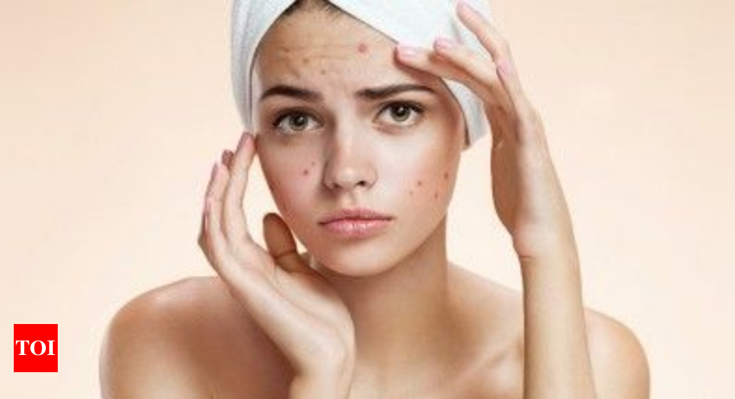 Home-made remedies for dark spots on the skin