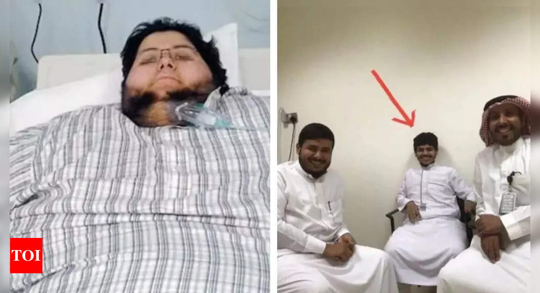 Transformation: Khalid Shaari, once the world’s heaviest man, loses 542 kg and is now unrecognizable at 63 kg