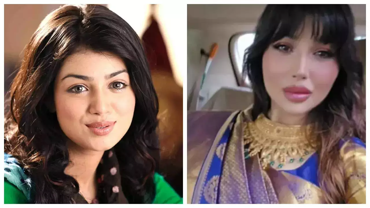 Ayesha Takia Plastic Surgery: Ayesha Takia deletes the picture after  netizens speculate she underwent plastic surgery | - Times of India