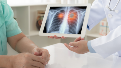 Lesser-known causes of lung cancer