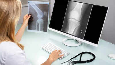 Shocking X-ray for knee pain reveals rare bone growth in man's ...