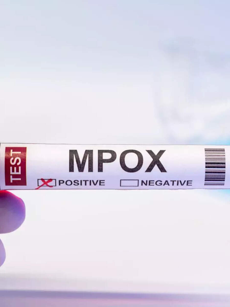 9 Distinct Signs Of Mpox That You Should Know Times Now