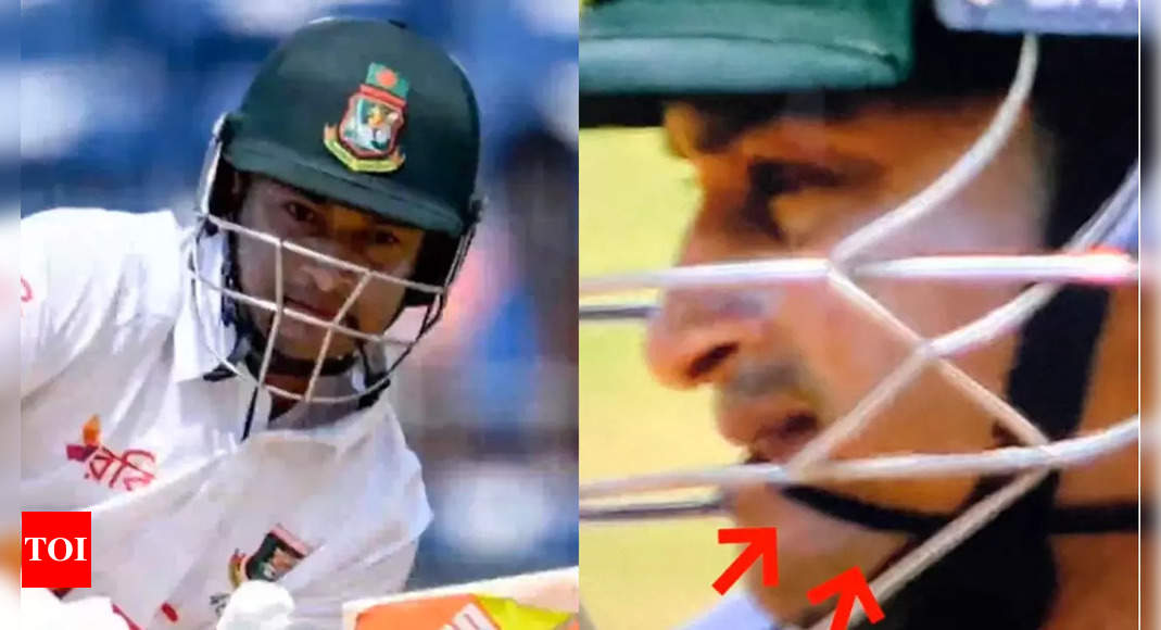 EXPLAINED: Why Bangladesh batsman Shakib Al Hasan is holding a band between his teeth while batting | Cricket News – Times of India