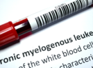 5 questions about Chronic Myeloid Leukemia answered