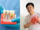 Root canal treatment causes heart attacks in people with no family history?