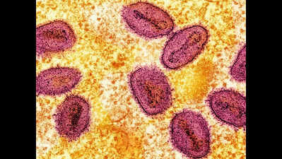 Symptoms of Mpox patient have started subsiding, all contacts traced, says health authorities