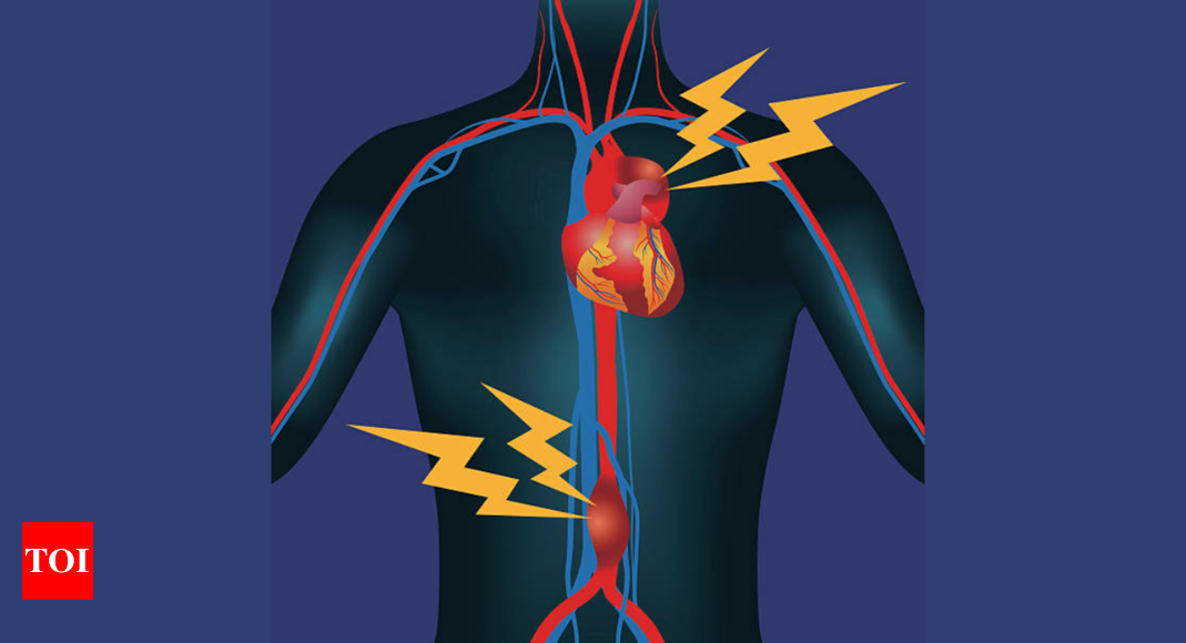 Extreme exercise and the potential cardiovascular risks – Times of India