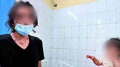 ‘Acid’ attack on Syrian refugee, son: Delhi activists cite loopholes in FIR by police