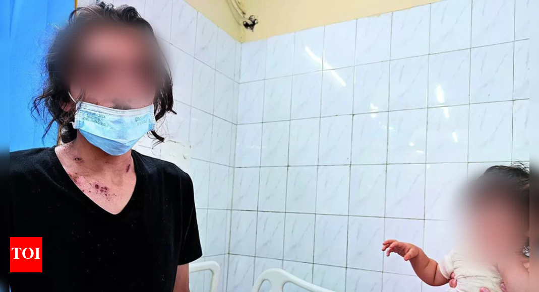 Acid Attack: Activists Point Out Legal Loopholes in Acid Attack Case ...
