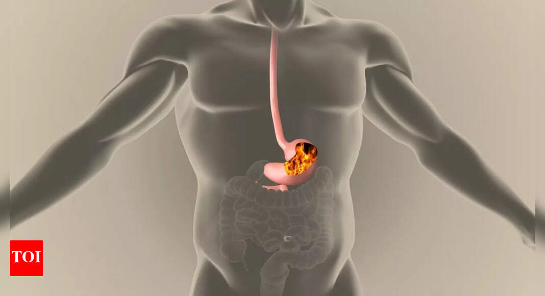Garlic Side Effects: Having too much garlic can cause these worrying ...