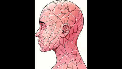 Surge in number of young stroke patients blamed on lifestyle, stress