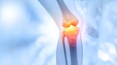 Can Ozempic and Wegovy relieve osteoarthritis pain? Key findings of the study