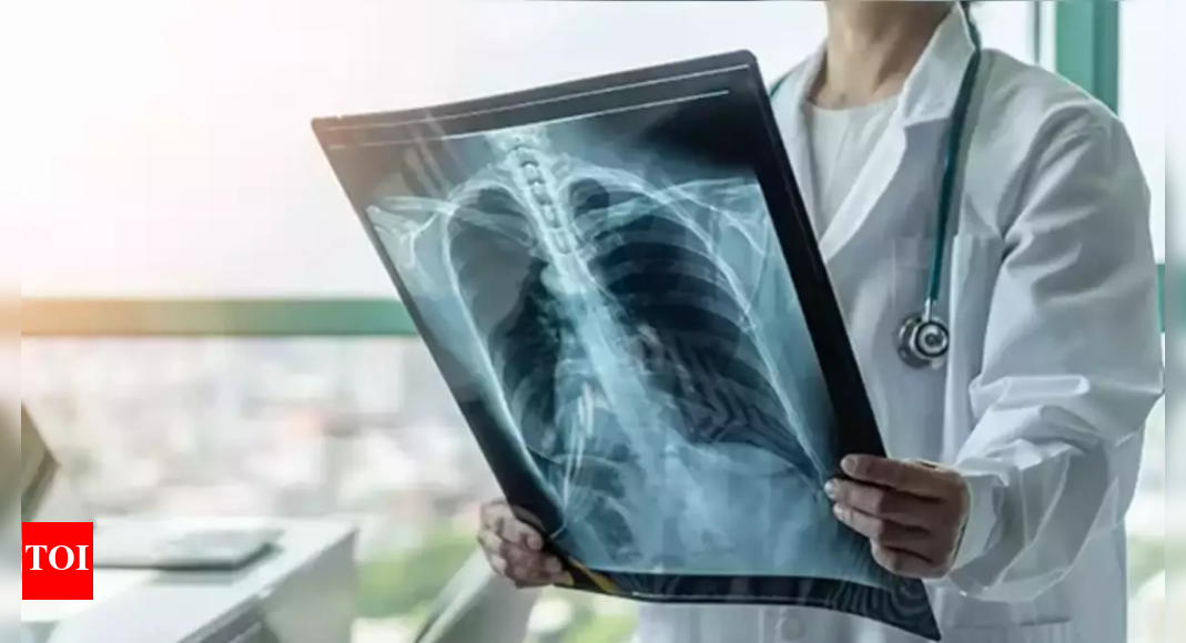 Mysuru's 100-Day Push to Eradicate Tuberculosis