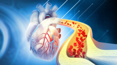 Why ldl cholesterol degree rises throughout iciness season | – Instances of India