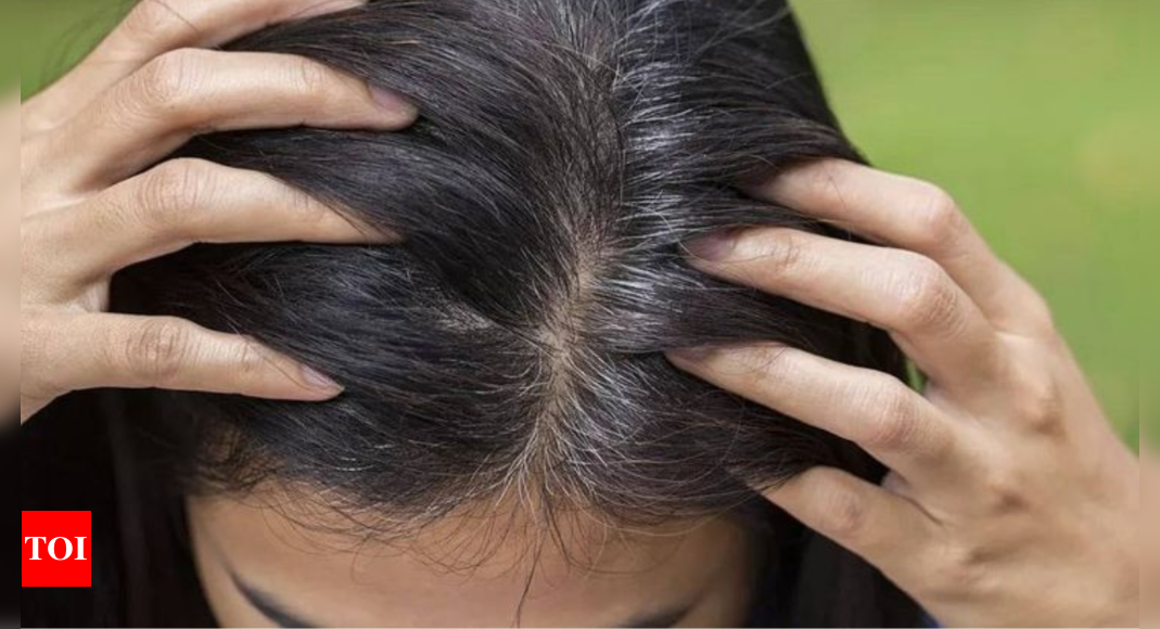 5 home remedies to try if you want dark black hair – Times of India