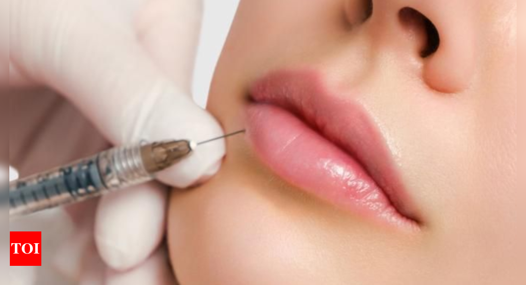 The rise of lip augmentation: Why fuller lips are here to stay