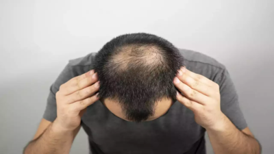 Panic in Maharashtra villages as people experience sudden hair loss