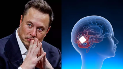 Elon Musk gives an update on Neuralink’s third human brain implant: ‘We upgraded…’