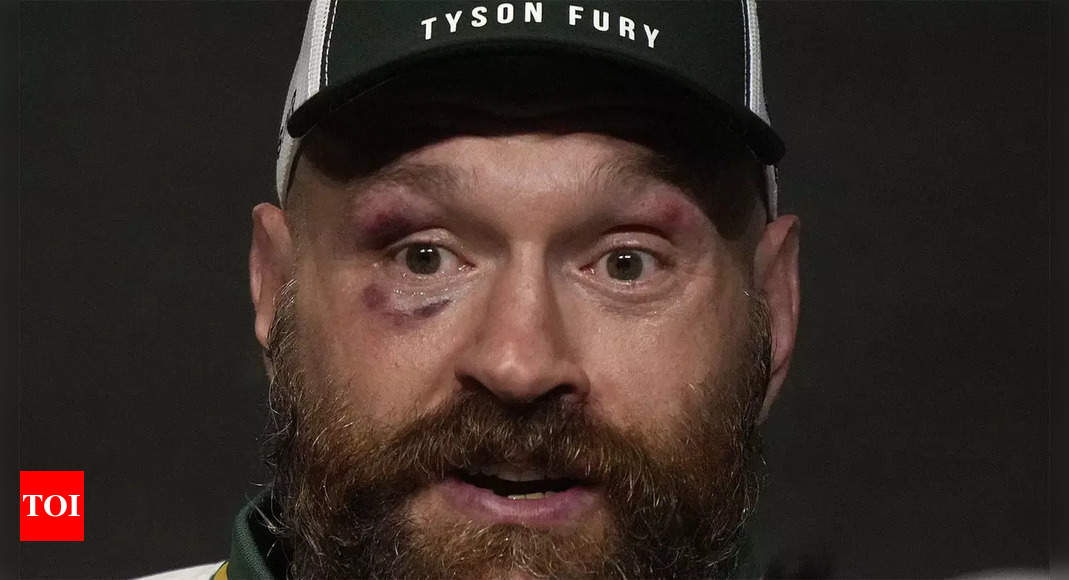 ​British heavyweight Tyson Fury declares retirement from boxing, once more | Boxing Information – Occasions of India